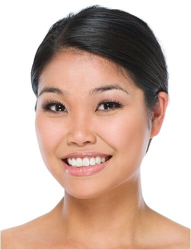 健康・医学 atlas of asian rhinoplasty A Practical Approach to Asian Rhinoplasty: How to Design A Fine